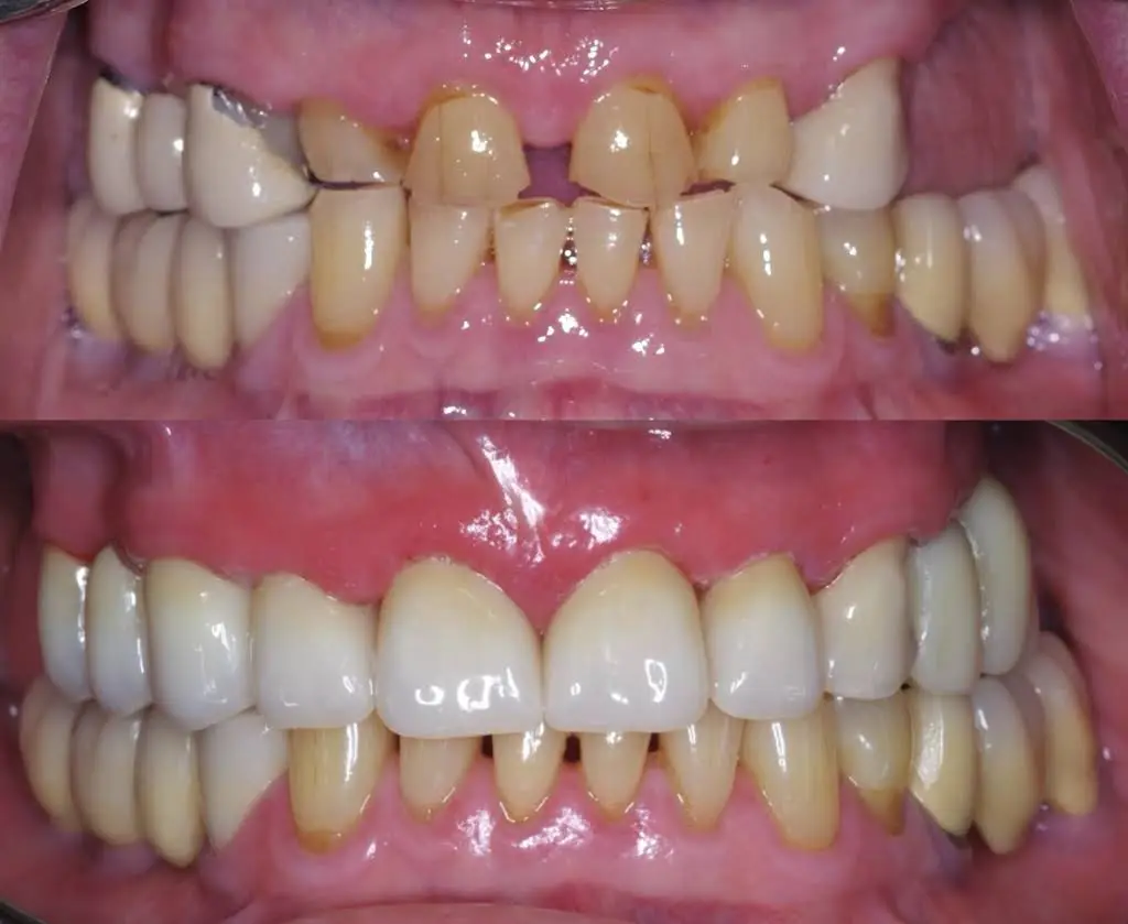 Buxmont Prosthodontics & Restorative Dentistry