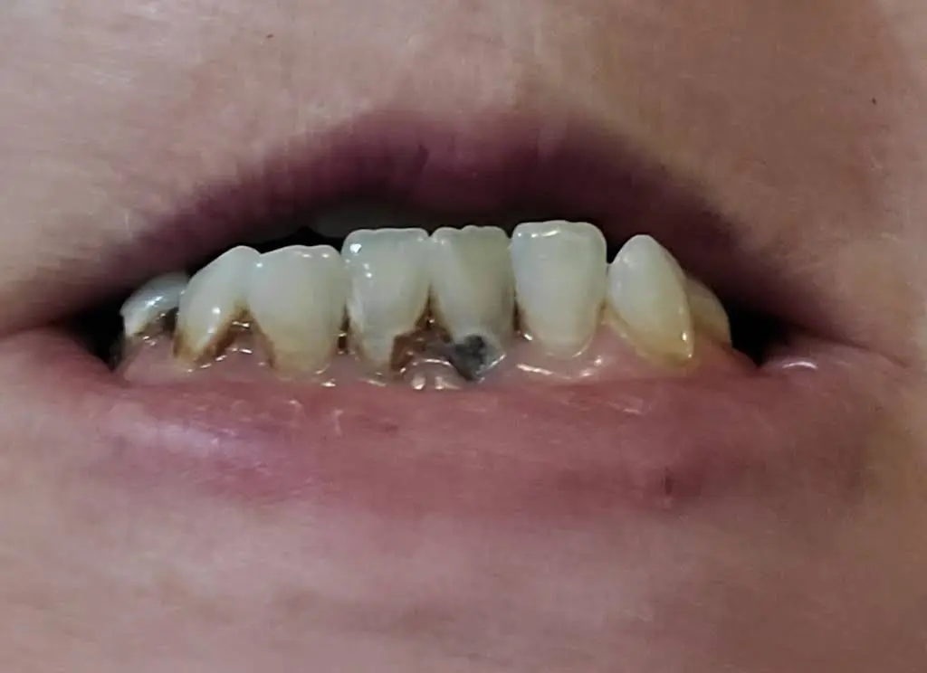 Inlet Premier Implant & Cosmetic Dentistry