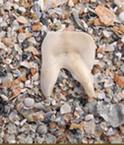 CR Smiles - Pawleys Island Dental Care, LLC