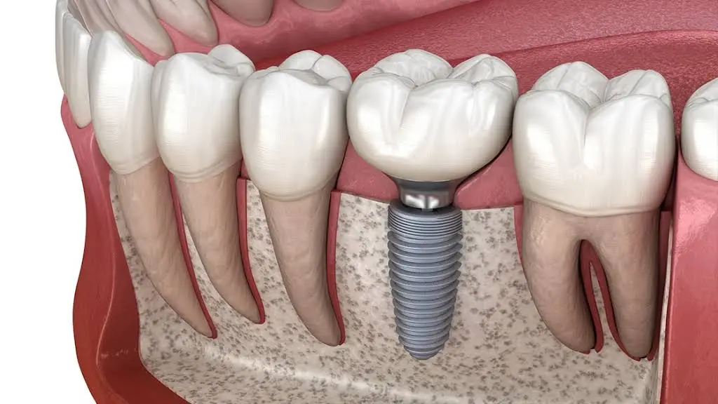 Crescent Family and Cosmetic Dentistry - Professional dental clinic exterior with modern facilities