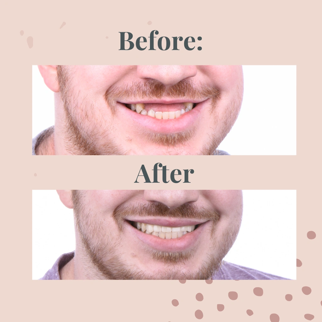 All On Implants and Modern Dentistry