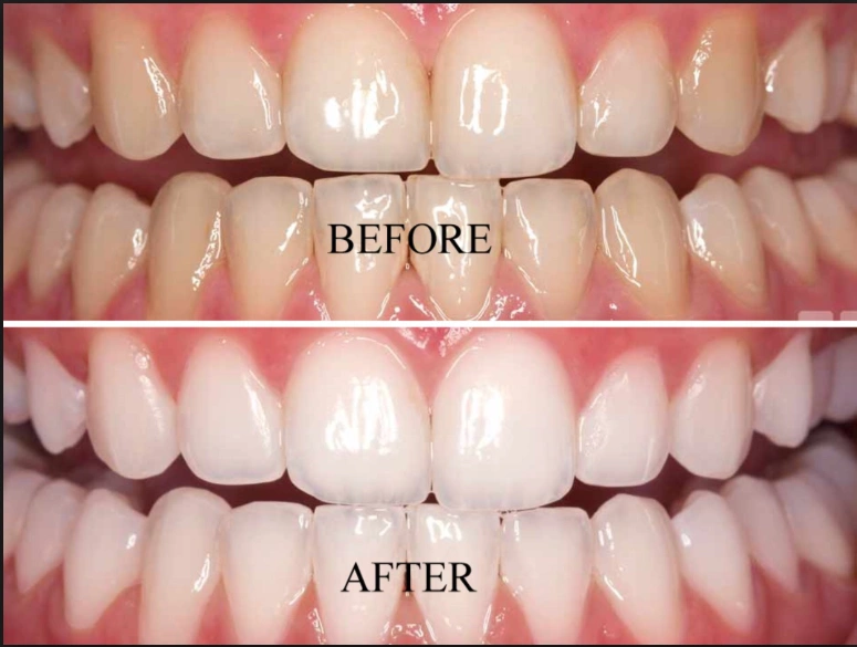 Bucks Dental Associates