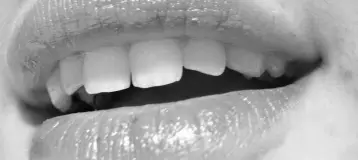 Branchburg Dental