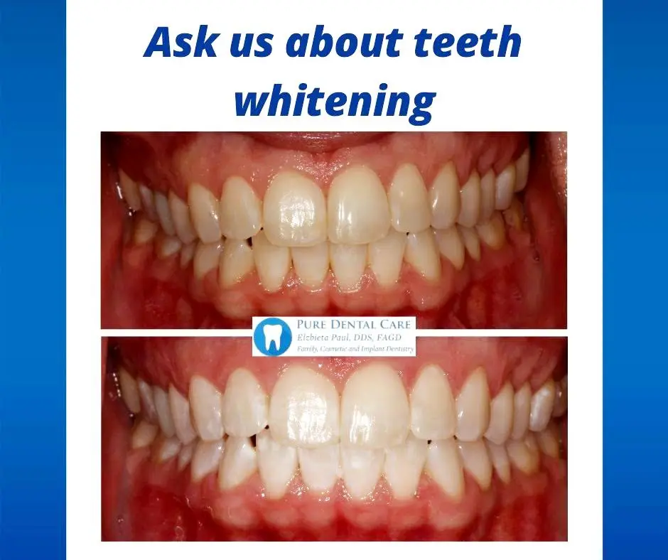 Pure Dental Care