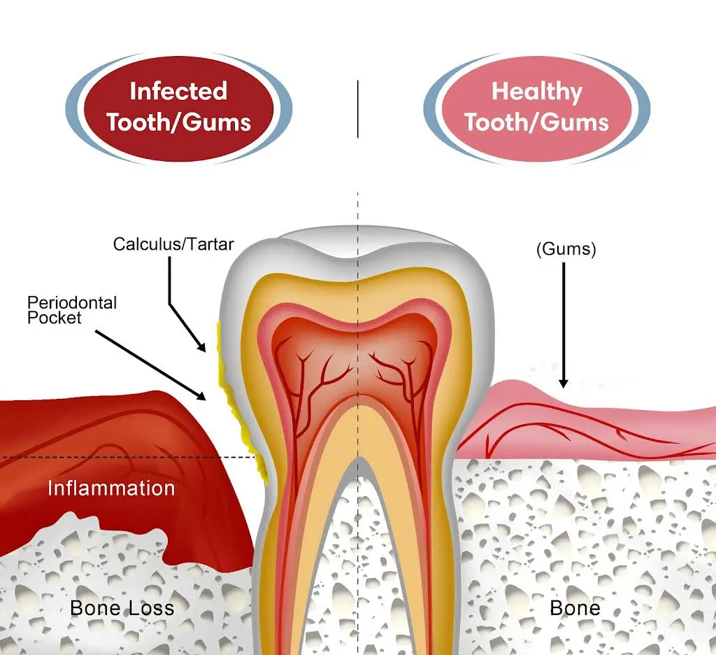 Sam B Khoury DDS MS - Dental Implant & Perio Surgeons