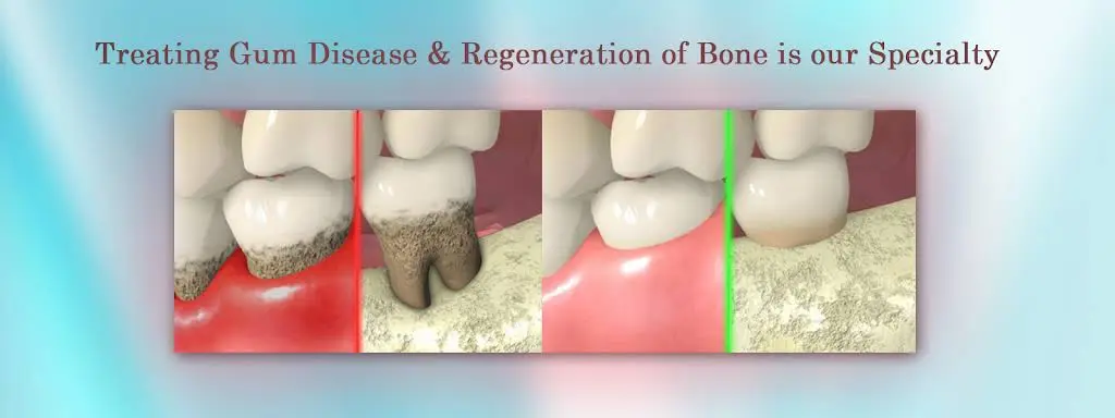 Sam B Khoury DDS MS - Dental Implant & Perio Surgeons