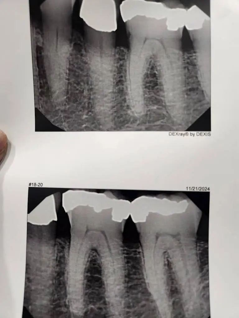 Midlands Endodontics