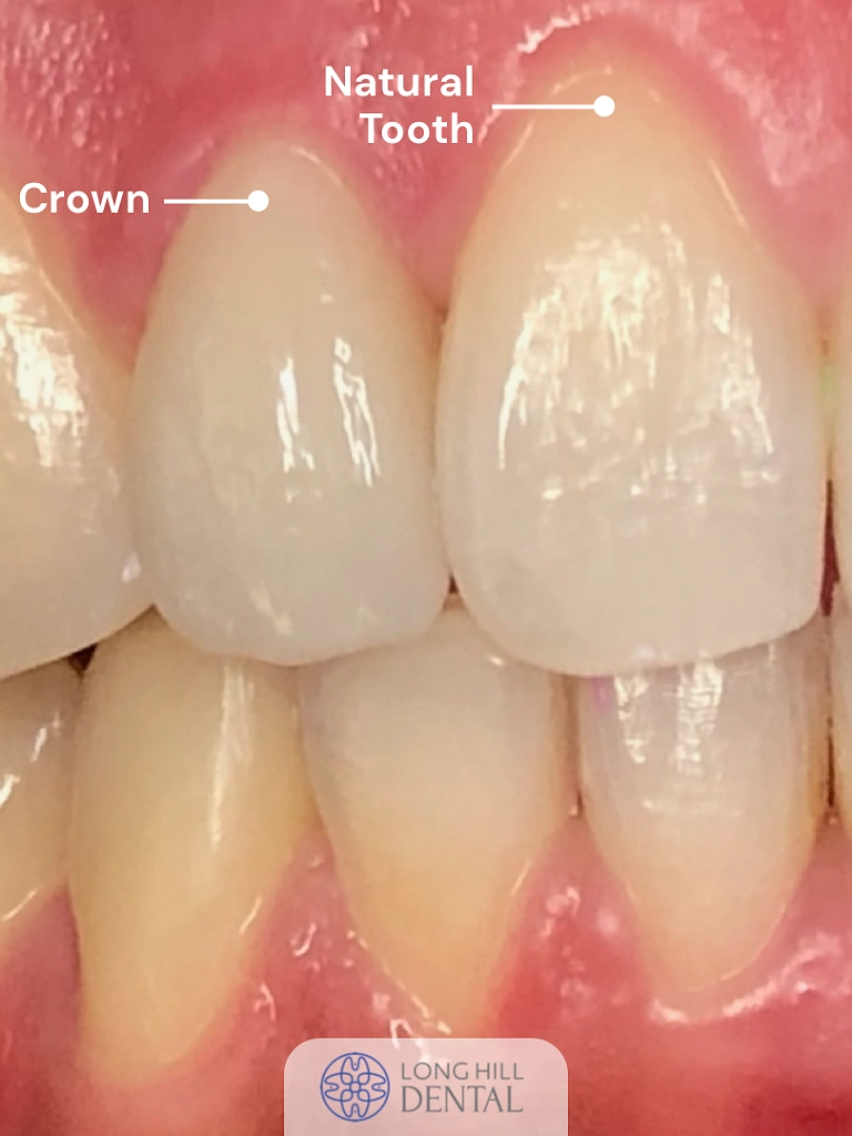 Long Hill Dental