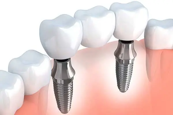 Global Dental Plus, Llc