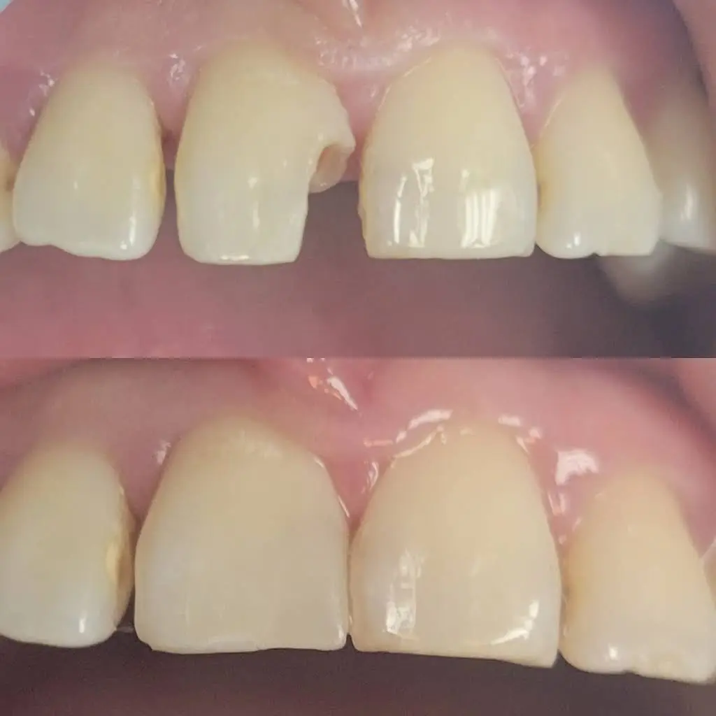 Florham Park Advanced Dentistry