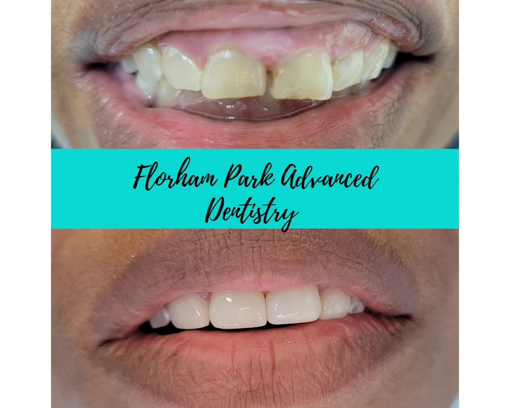 Florham Park Advanced Dentistry