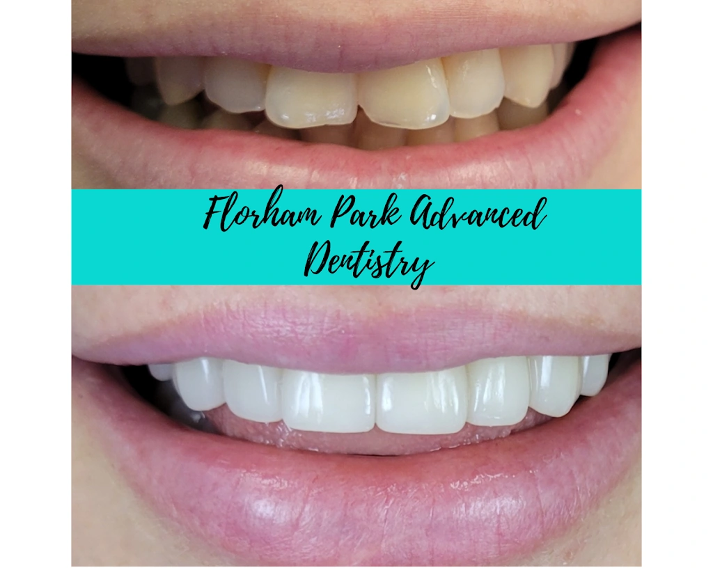 Florham Park Advanced Dentistry
