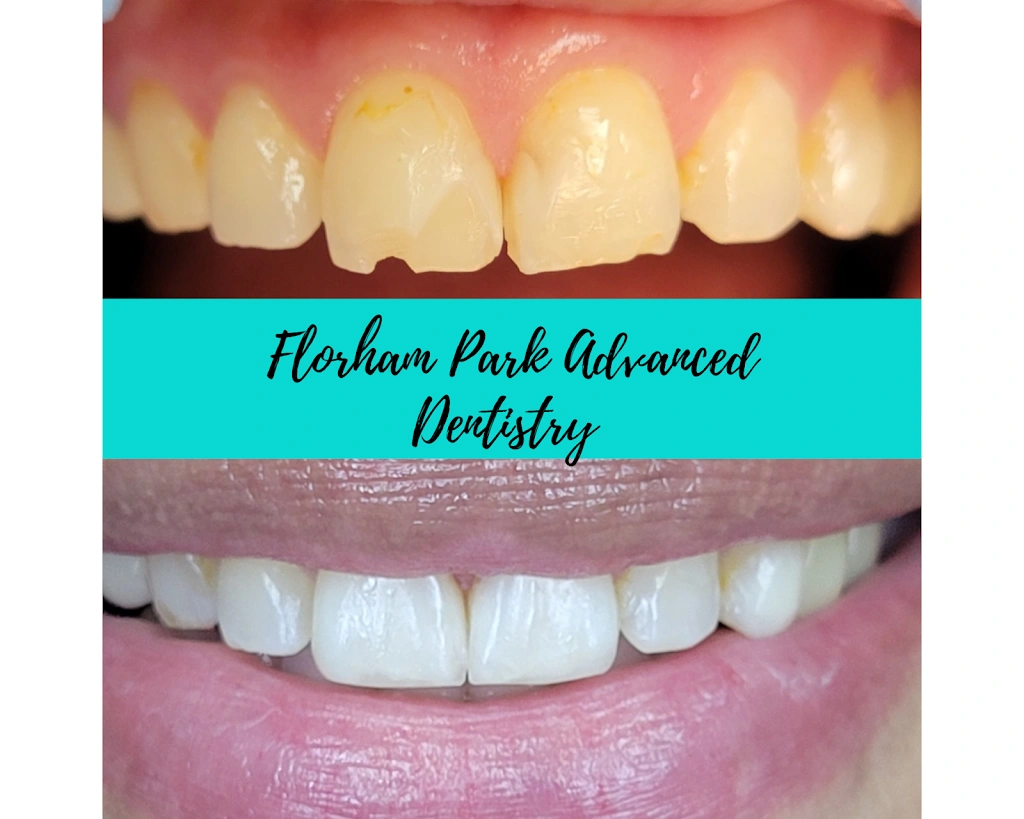 Florham Park Advanced Dentistry