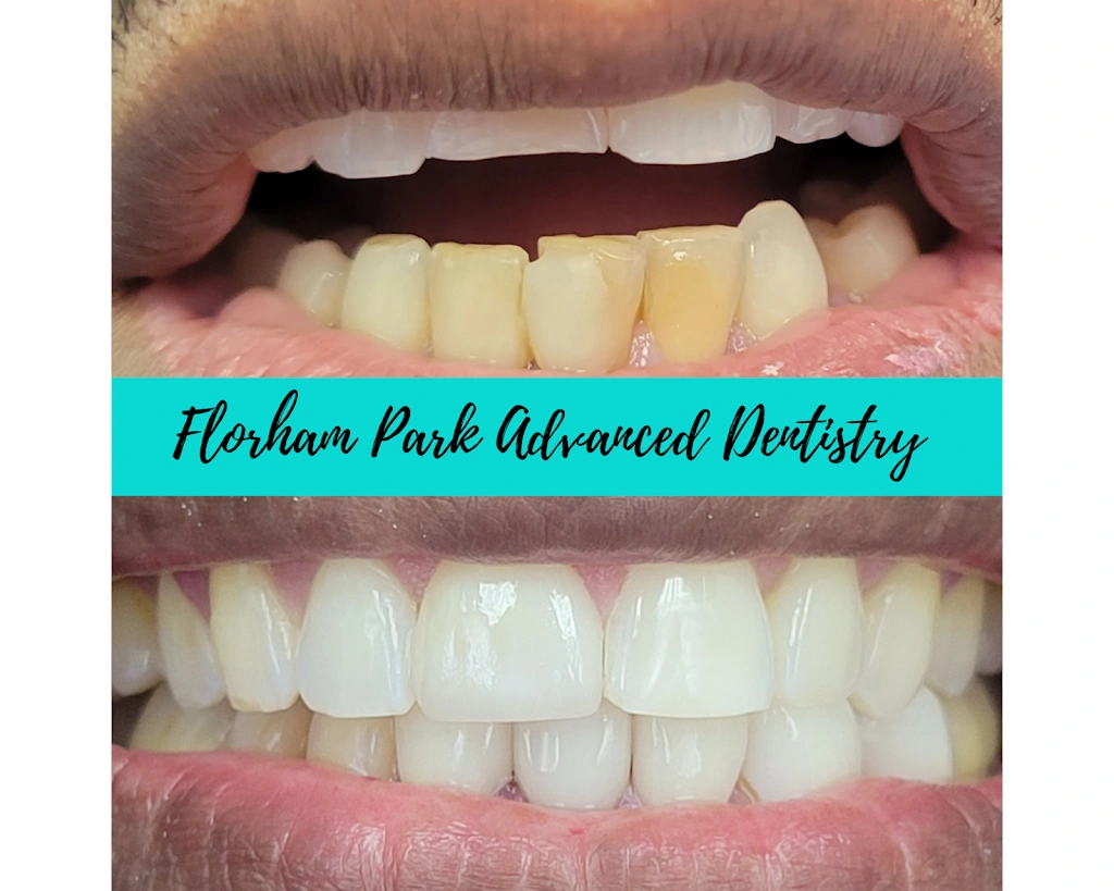 Florham Park Advanced Dentistry