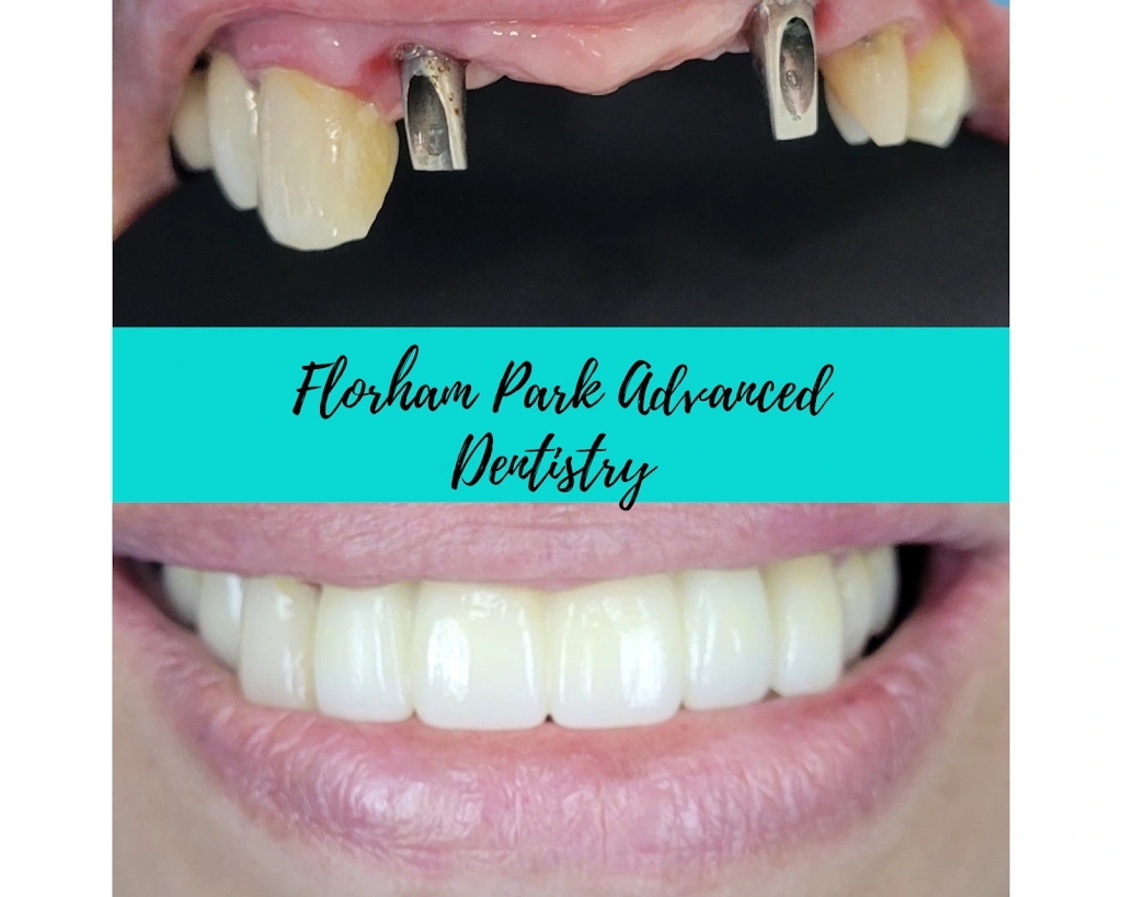 Florham Park Advanced Dentistry