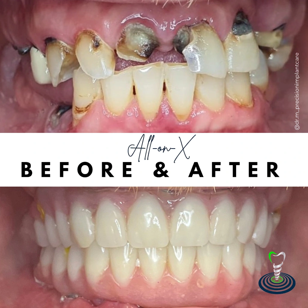 Precision Implant Care | Dr. Robert Mikhli - Professional dental clinic exterior with modern facilities
