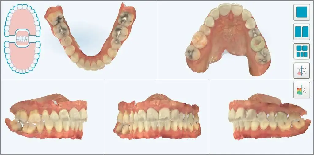 Precision Implant Care | Dr. Robert Mikhli