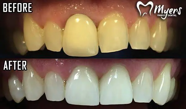 Myers Family Dental