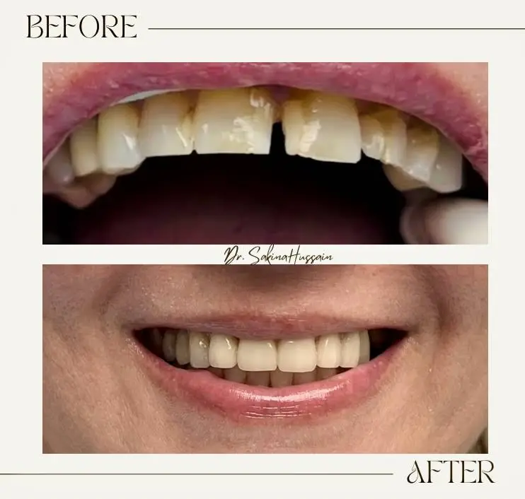 Smile Haven Dentistry - Sakina Hussain, DDS