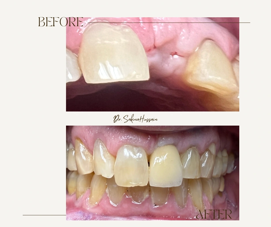 Smile Haven Dentistry - Sakina Hussain, DDS