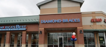 Diamond Braces