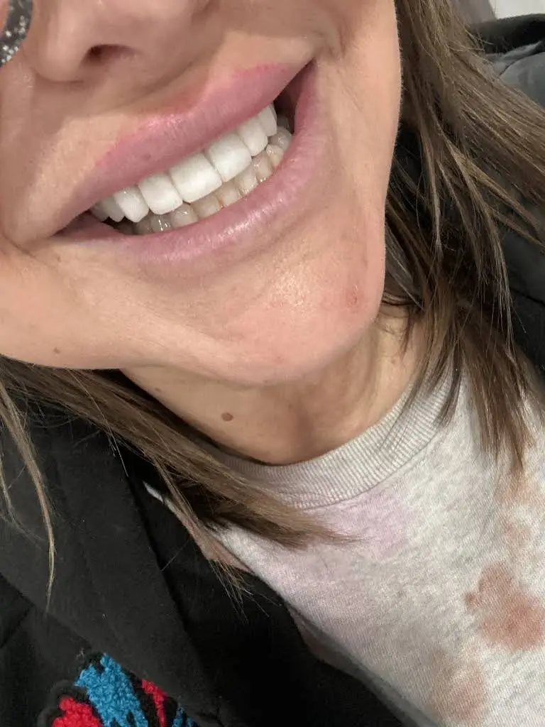 Smile Perfection