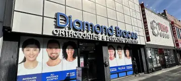 Diamond Braces