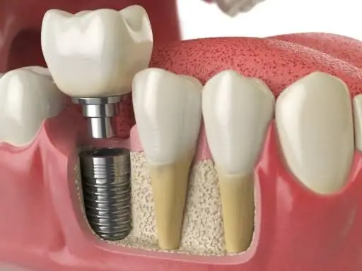 Canarsie Family Dentistry