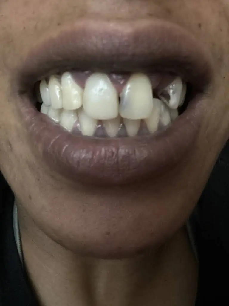 NYU Dentistry