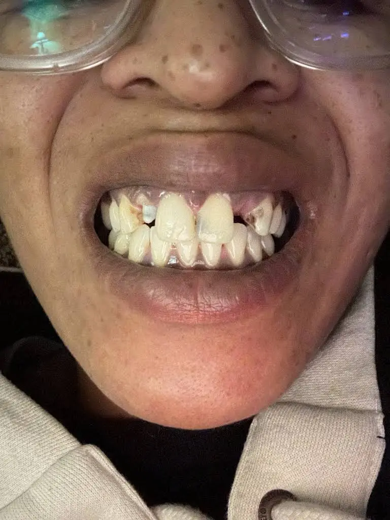 NYU Dentistry