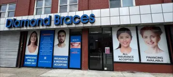 Diamond Braces