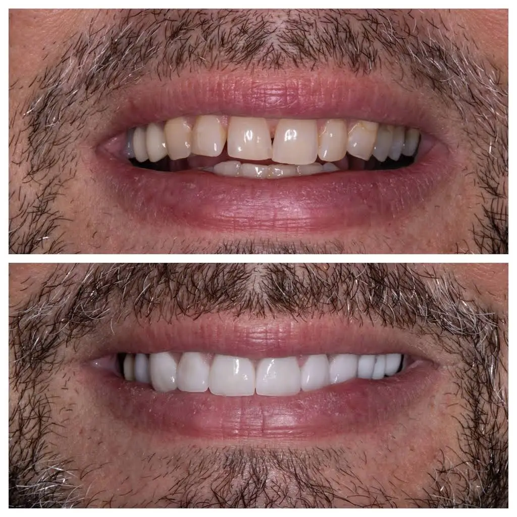 b Dental Spa at Totowa - Professional dental clinic exterior with modern facilities