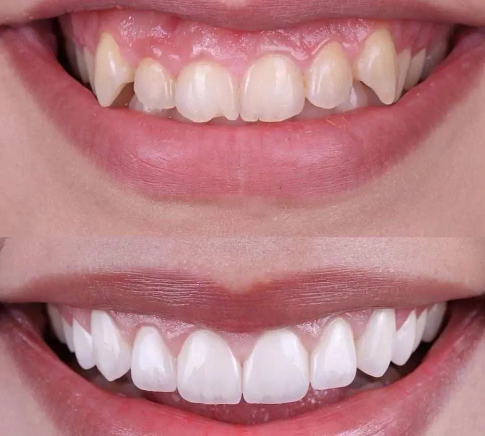 NÜVA Smile - Professional dental clinic exterior with modern facilities