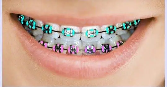 Glenridge Orthodontics