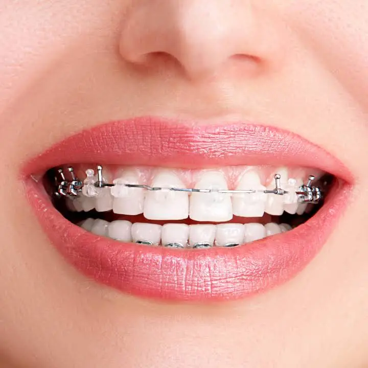 Gen Z Dentistry