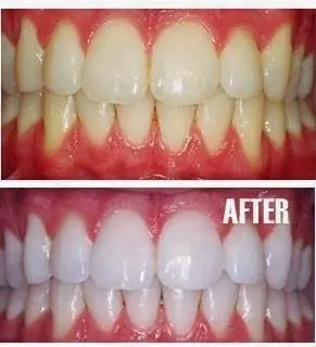 Valley Road Dental Excellence: Scott B. Schaffer, DMD