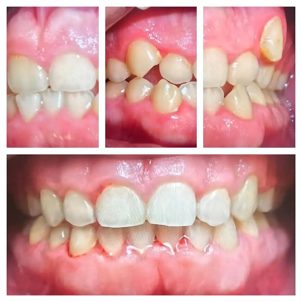 Allstate Dental