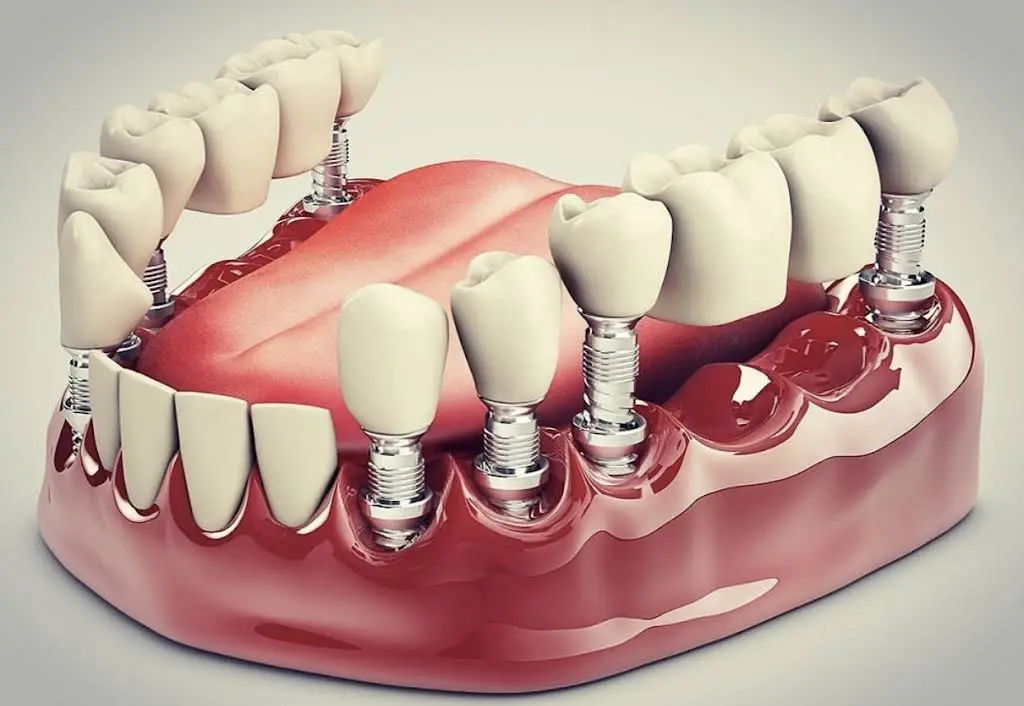 Allstate Dental