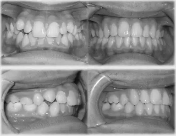 Allstate Dental