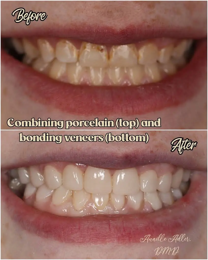 Advanced Dentistry of Queens