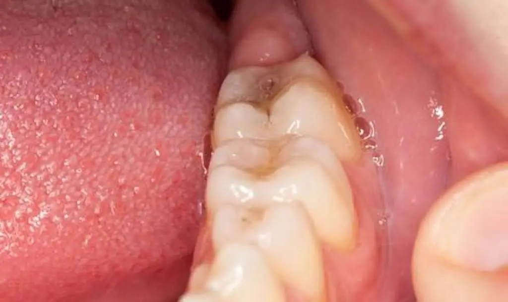 Trovato Family Laser Dentistry