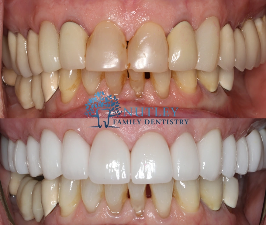 Nutley Family Dentistry