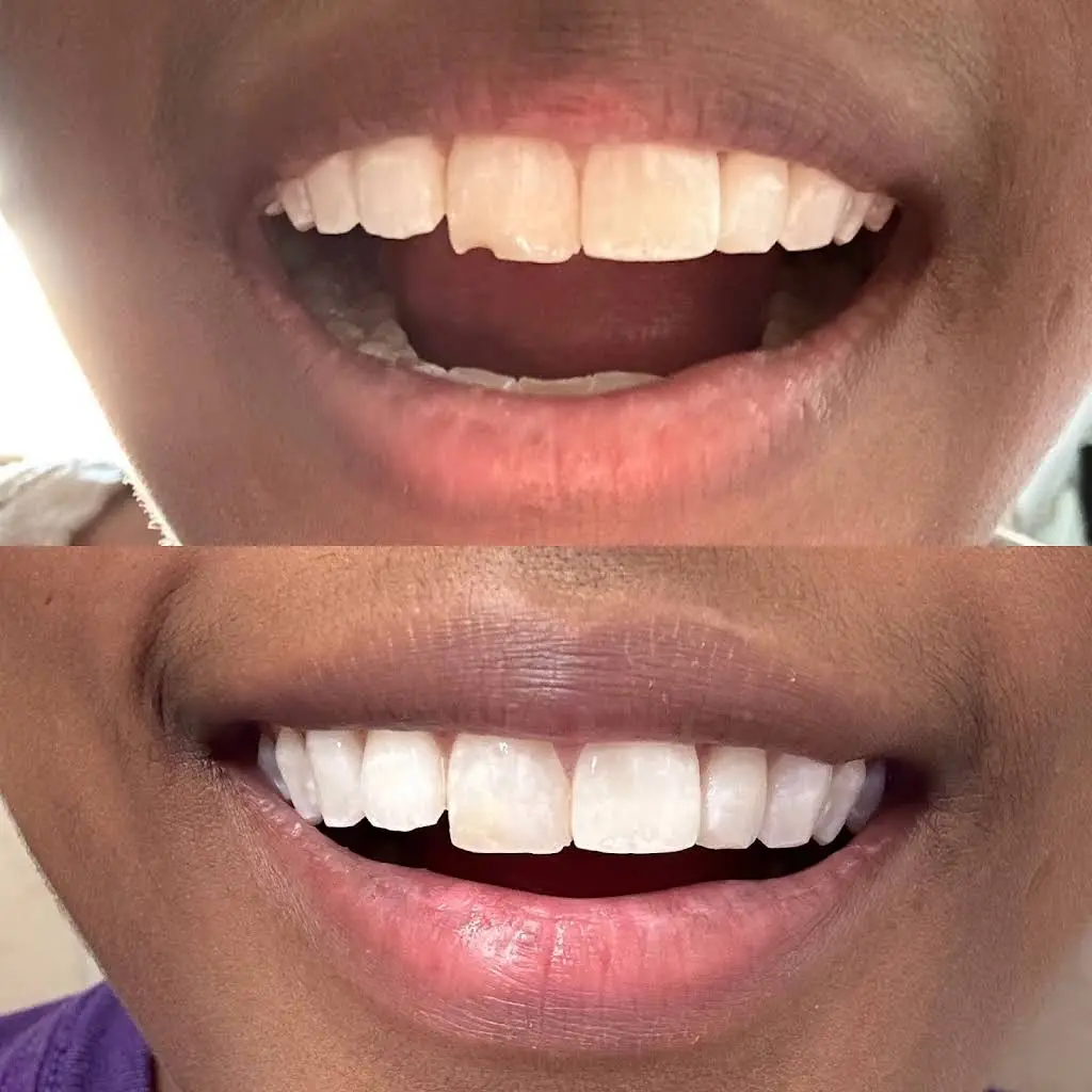 All Smiles General Dentistry
