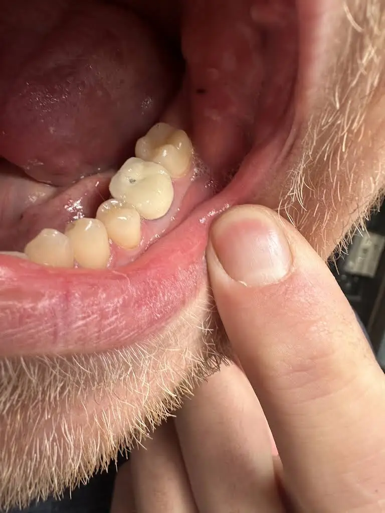 Perfect Dental Care