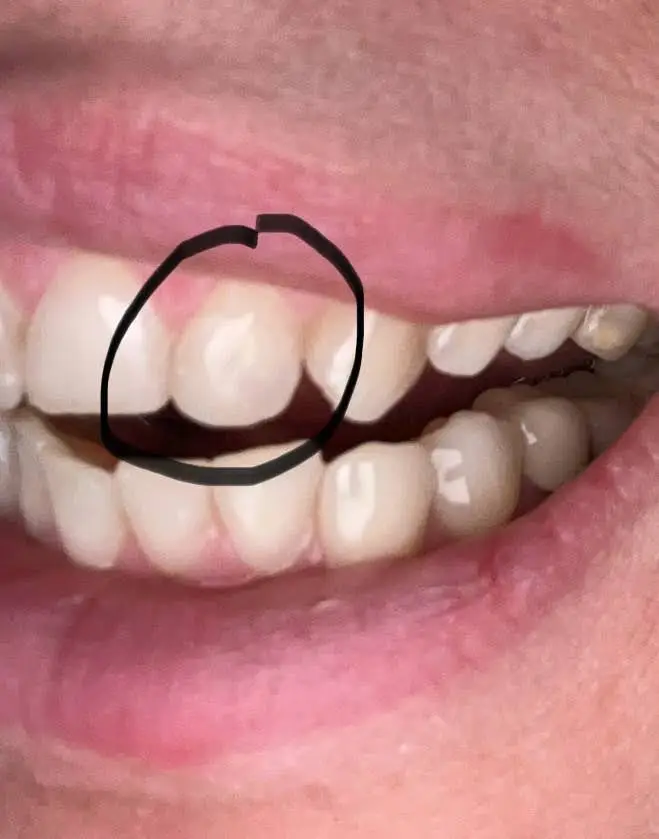 Perfect Dental Care