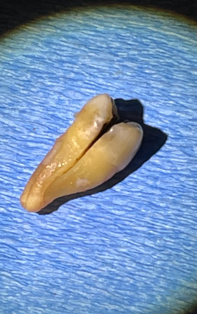 Emergency Dentist NYC