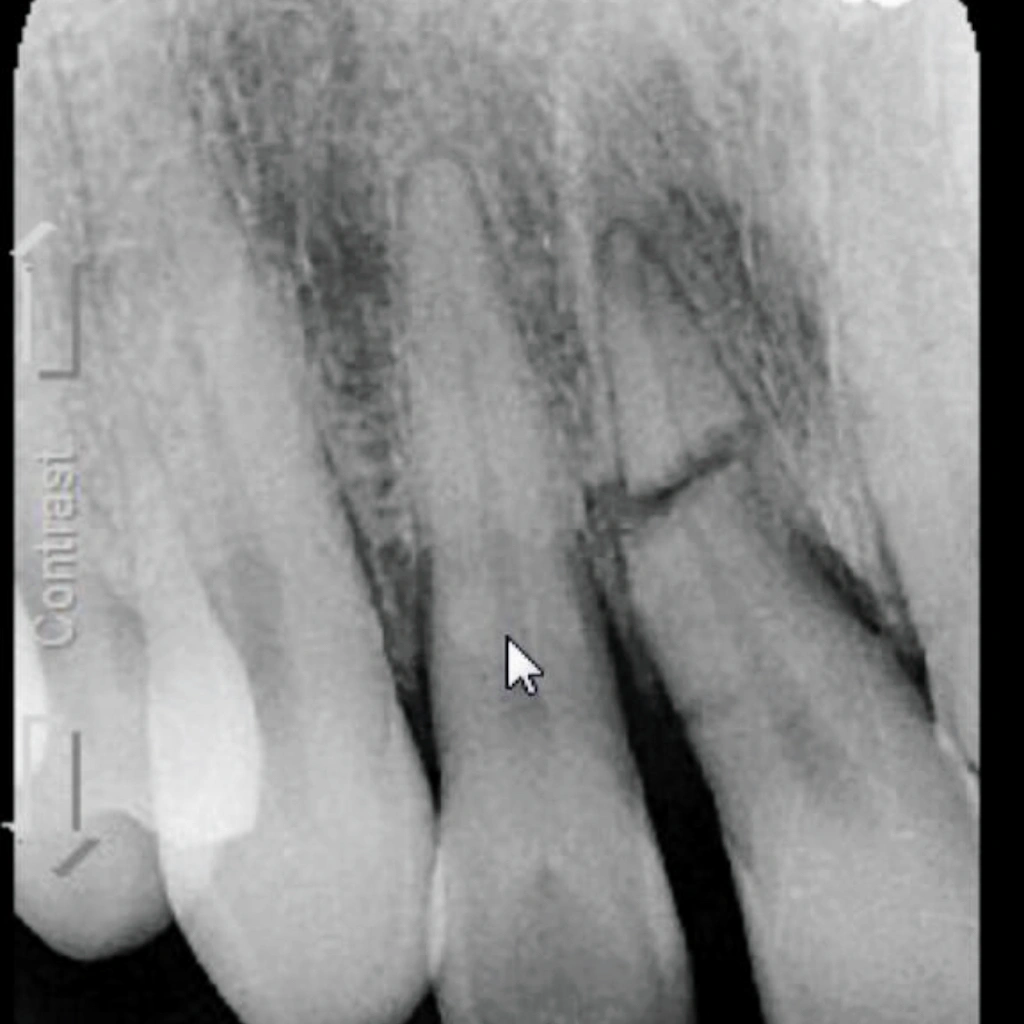 Emergency Dentist NYC