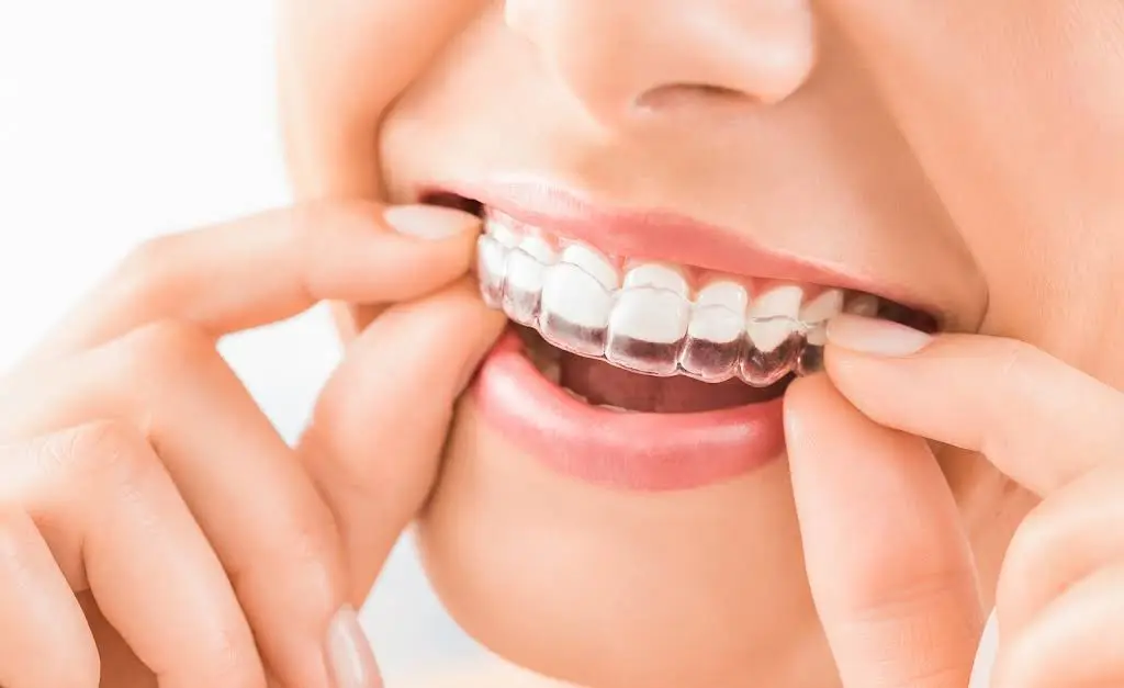 A-1 Perfect Smiles of Clifton - Professional dental clinic exterior with modern facilities