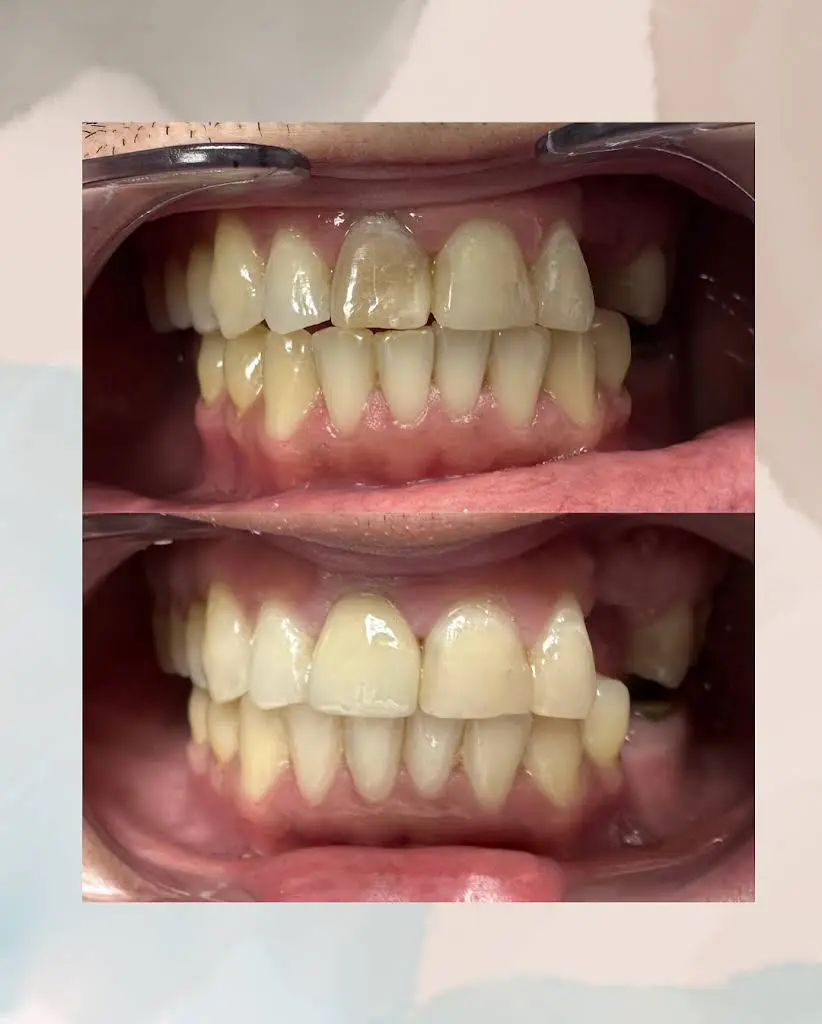 Simple Smiles Dentistry of Paterson - Professional dental clinic exterior with modern facilities