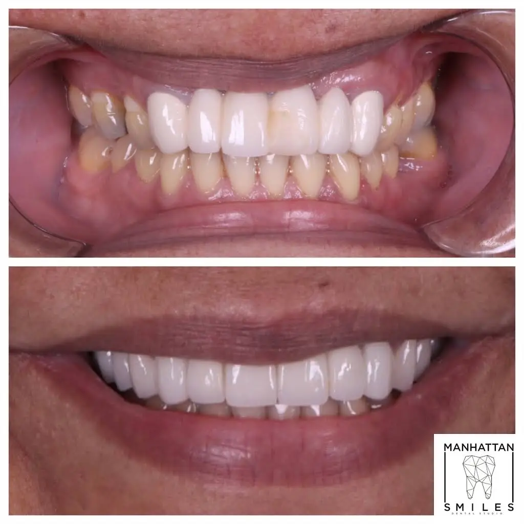 Manhattan Smiles Dental Studio